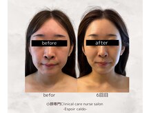 エスポワールカルド(Espoir caldo)/