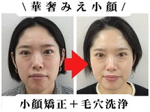 【BUPURA式3TS法】小顔矯正専門店BUPURA一宮店〈ブプラ〉