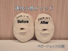 薬手名家 心斎橋店/お客様ビフォーアフター