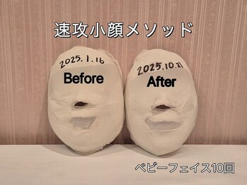 薬手名家 心斎橋店/お客様ビフォーアフター