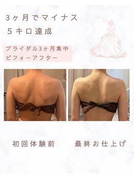 ティアラ(Tiara)/