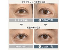 ステラ(Stella)/LEDコーティング