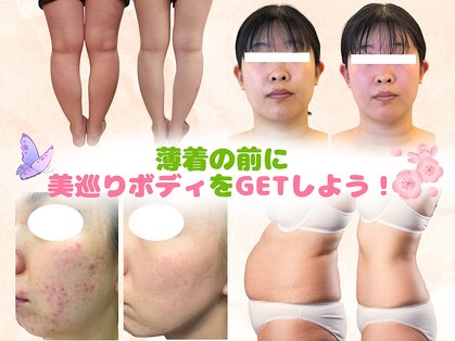 ヨサパーク ラ ぺ(YOSAPARK La paix)の写真