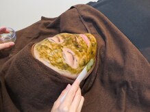 イロドリ(IRODORI)の雰囲気（ハーブピーリング×イオン導入で叶える本格肌質改善ケア◎）