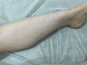 ナノハナ/鹿沼市全身脱毛美容室ナノハナ