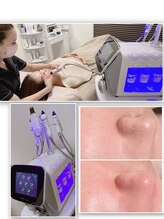 ル ソーガ(Le soga)/川西市内初！ハイドラ導入店