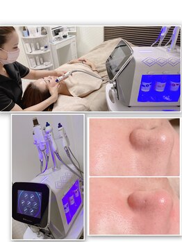 ル ソーガ(Le soga)/川西市内初！ハイドラ導入店