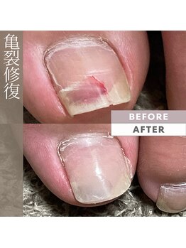 プリンチペッサジゼル/亀裂修復