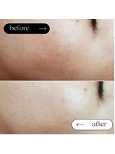 トータルビューティーサロンリア(Li'a)/ビフォー＆アフター