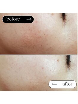 トータルビューティーサロンリア(Li'a)/ビフォー＆アフター