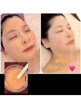 ティアラ(TIARA)/モデリングパック