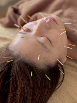 まこと鍼灸院の写真/年齢のせいにしない、私を取り戻す。美容鍼で叶える小顔ケア◎キュッと引き締まった本来のフェイスライン