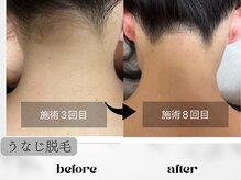 サロン ド ジュエル(salon de jewel)