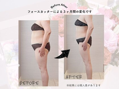 ジェイレナータ(J.RENATA)の写真