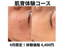 アイビーケア 三田(ivy care)