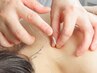 【平日11時~16時開始限定★】鍼灸+全身整体もみほぐし 60分 10000→9500