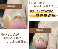 町田市巻き爪センター