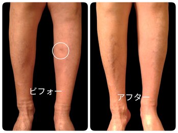 フットケアサロン ラビフット(Rabbi foot)の写真/専門サロンの技術で足のトラブルケアも怠さもスッキリ！頑張る足に爪・角質・足の疲労感も一気に解消！