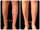 フットケアサロン ラビフット(Rabbi foot)の写真/専門サロンの技術で足のトラブルケアも怠さもスッキリ！頑張る足に爪・角質・足の疲労感も一気に解消！