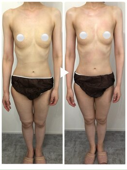 ヴェルナ(VELUNA)の写真/肩こり・姿勢・むくみまで全身から整える☆魅力ある女性らしいボディラインとバストへ導きます♪