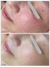 ルシアル(Rucial)/ハーブの力でお肌の土台から綺麗