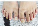 フットネイル