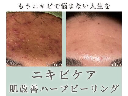 モニ 福岡(Moni)の写真
