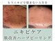 モニ 福岡(Moni)の写真