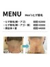 【ご新規様】ヒゲ脱毛（頬・アゴ） ¥3500→¥2000
