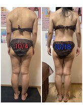 ナッツ(Nuts)/WINBACK下半身