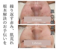 リブラン(Libran)