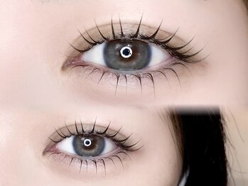 ロム(ROM)/ラッシュリフト上下