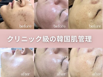 グランクウォーレ(Gran Cuore)の写真