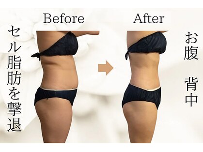 タノソイネ(tanosoine)の写真