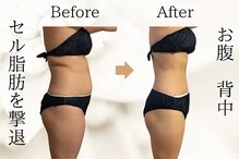 タノソイネ(tanosoine)