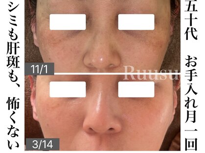 ルウス(Ruusu)の写真