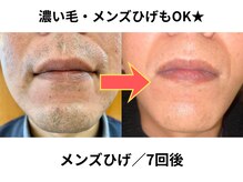 NTエステティック 西条店/