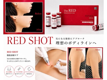 ベルーナ(Belluna)の写真