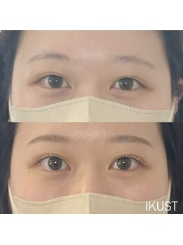 イクスト 吉祥寺(IKUST)の写真/新体験!黄金比はもちろん骨格や雰囲気、筋肉を見て一人一人に似合う眉毛に!
アイブロウ/眉毛/まゆげ