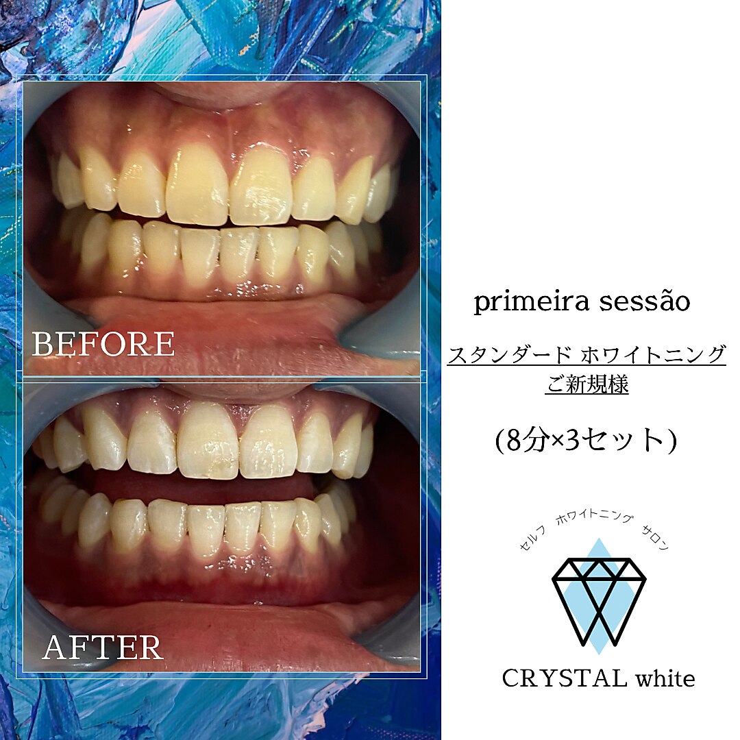 クリスタルホワイト(CRYSTAL white)|ホットペッパービューティー