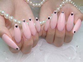 チップスカルプ