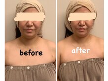 ララ(LALA)/＃姪浜エステ＃姪浜フェイシャル