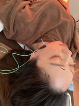 ハリファ鍼灸院 横浜関内院(HariFa鍼灸院)/リフトアップ美容鍼