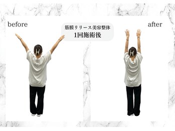 トキ(TOKI)/筋膜リリース美容整体 施術後
