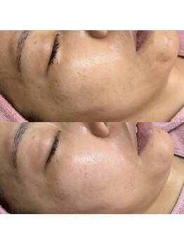 シロ(siro)/韓国水光肌・美白フェイスWax