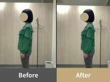 整体クオーレ 奈良新大宮店(Cuore)/Before After