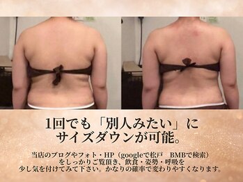ビーエムビー(BMB)の写真/憧れのシルエットへ！サイズダウンを目指したい方必見◎1回でも「別人みたい」と感動の声続出！
