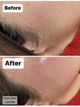 ルアナ ナオ(Luana Nao)/毛によるくすみ知らず！