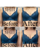 クオン(Qon)/BBLバストケアの途中経過☆