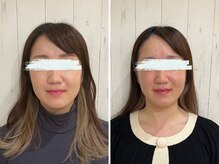 コルギ専門店 マキシフォート 栄店(Maxifort)/小顔コルギ体験レポート